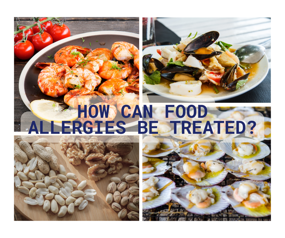How can food allergies be treated?